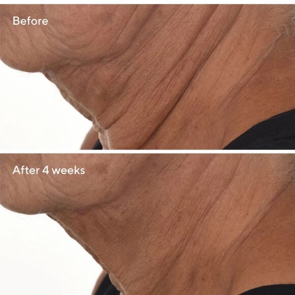 MURAD Retinal resculpt overnight treatment NEW 1 OZ. - Picture 7 of 16